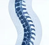 Spine Disorders
